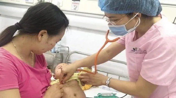 Gia tăng mắc bệnh thủy đậu ở trẻ em tại nhiều tỉnh miền Bắc, cha mẹ đừng chủ quan